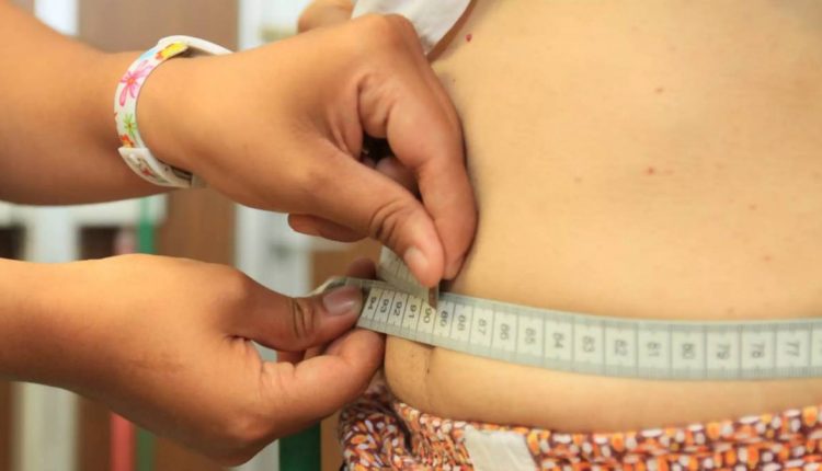 Sobrepeso, obesidad infantil , salud, pie plano